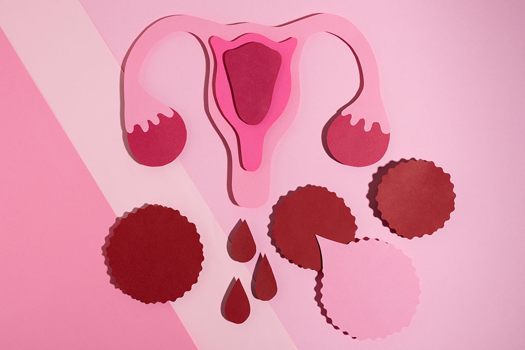 causes-symptoms-of-abnormal-uterine-bleeding-exploring-heavy-flows